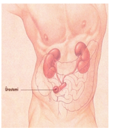 stoma-3.png